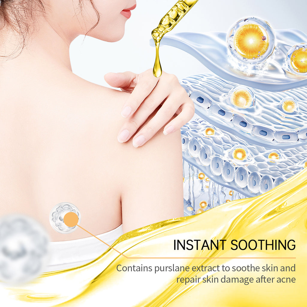 Skin Care Set Care Tender-Acne Skin